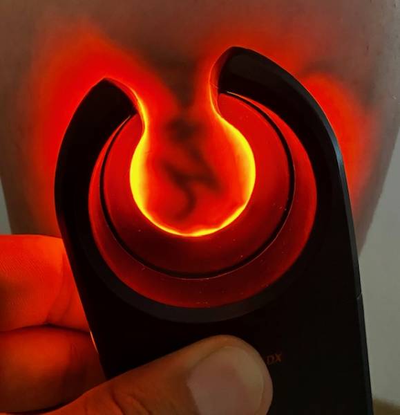 Traiter les varices des jambes pour éviter des complications à Miramas