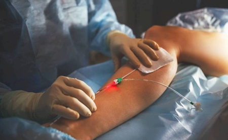 Notre zone d'activité pour ce service angiologue traitement varices