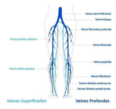 Notre zone d'activité pour ce service Traitement des varices par laser endoveineux avec anesthésie locale et résultats rapides sans cicatrices ni hospitalisation prolongée